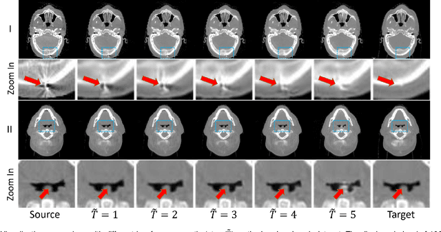 Figure 2 for Zero-shot Medical Image Translation via Frequency-Guided Diffusion Models