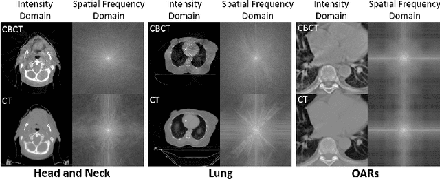 Figure 1 for Zero-shot Medical Image Translation via Frequency-Guided Diffusion Models