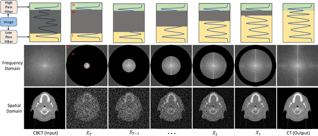 Figure 4 for Zero-shot Medical Image Translation via Frequency-Guided Diffusion Models