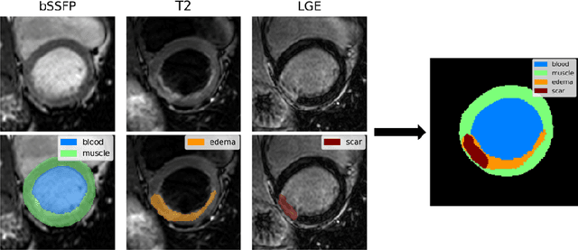 Figure 1 for Deep Gaussian mixture model for unsupervised image segmentation