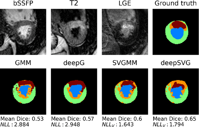 Figure 3 for Deep Gaussian mixture model for unsupervised image segmentation