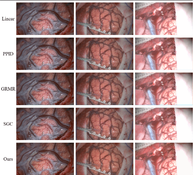 Figure 2 for A self-supervised and adversarial approach to hyperspectral demosaicking and RGB reconstruction in surgical imaging