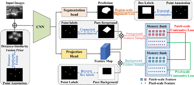 Figure 1 for Beyond Point Annotation: A Weakly Supervised Network Guided by Multi-Level Labels Generated from Four-Point Annotation for Thyroid Nodule Segmentation in Ultrasound Image