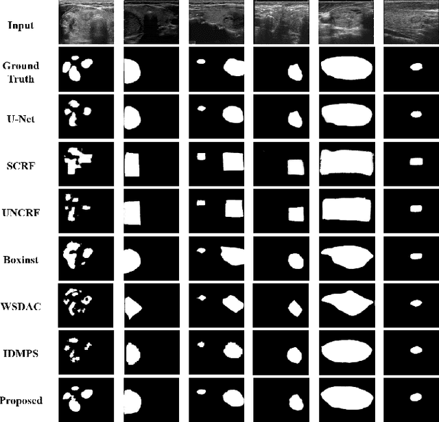 Figure 2 for Beyond Point Annotation: A Weakly Supervised Network Guided by Multi-Level Labels Generated from Four-Point Annotation for Thyroid Nodule Segmentation in Ultrasound Image