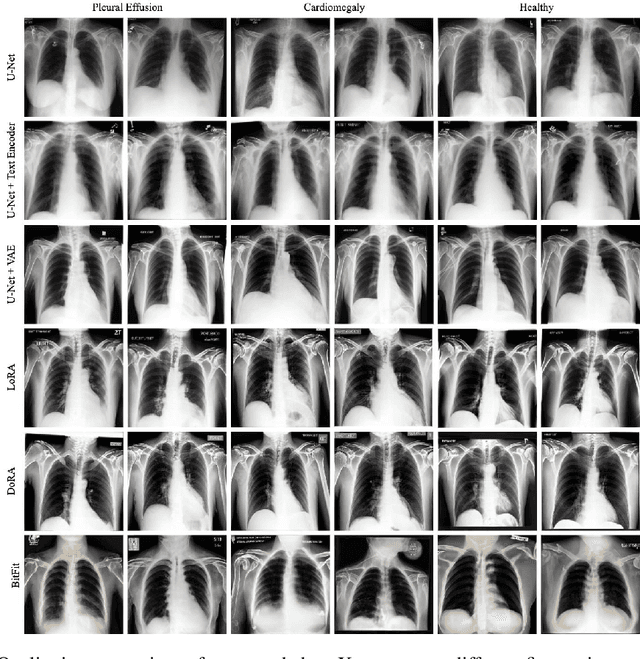 Figure 4 for Pixels Under Pressure: Exploring Fine-Tuning Paradigms for Foundation Models in High-Resolution Medical Imaging