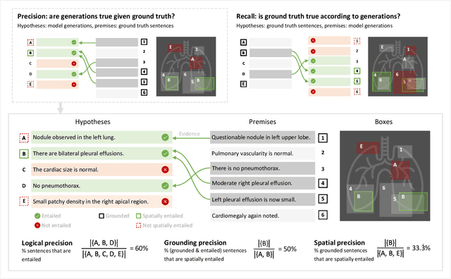 Figure 4 for MAIRA-2: Grounded Radiology Report Generation