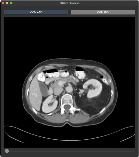 Figure 3 for Transversal PACS Browser API: Addressing Interoperability Challenges in Medical Imaging Systems