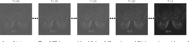 Figure 3 for A Deep-Learning-Based Label-free No-Reference Image Quality Assessment Metric: Application in Sodium MRI Denoising