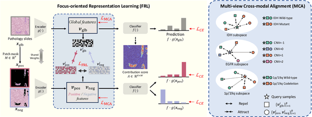 Figure 1 for Focus on Focus: Focus-oriented Representation Learning and Multi-view Cross-modal Alignment for Glioma Grading