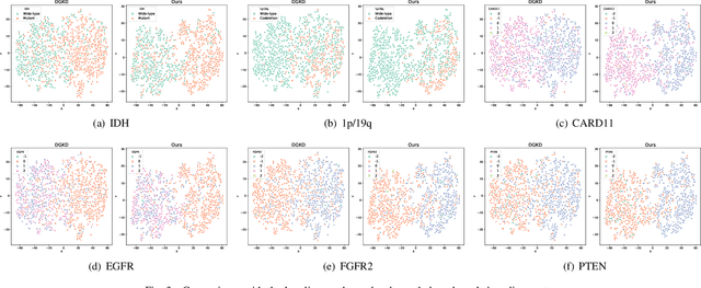 Figure 3 for Focus on Focus: Focus-oriented Representation Learning and Multi-view Cross-modal Alignment for Glioma Grading