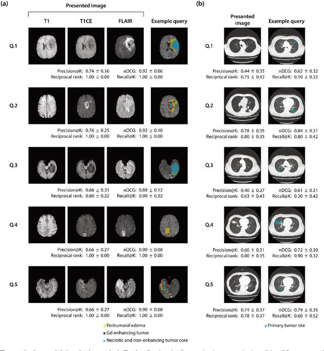 Figure 3 for Sketch-based Medical Image Retrieval