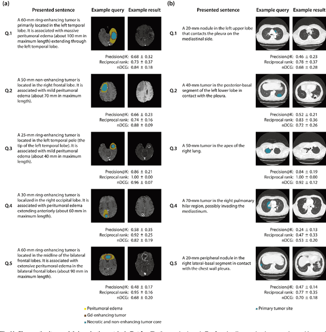 Figure 4 for Sketch-based Medical Image Retrieval