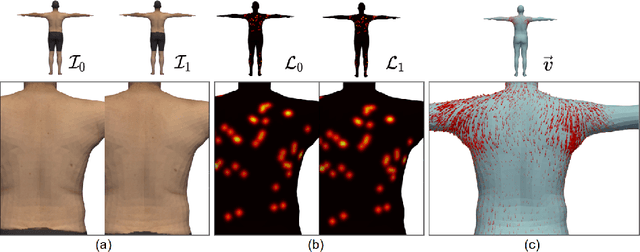 Figure 3 for Revisiting Lesion Tracking in 3D Total Body Photography