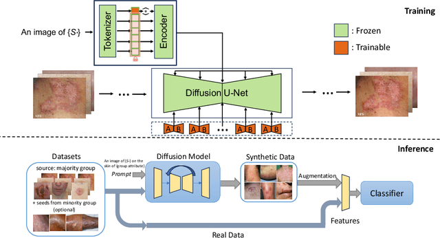 Figure 1 for From Majority to Minority: A Diffusion-based Augmentation for Underrepresented Groups in Skin Lesion Analysis