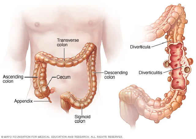 Figure 1 for Attention and Pooling based Sigmoid Colon Segmentation in 3D CT images