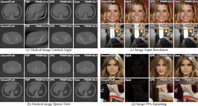 Figure 1 for Iterative Reconstruction Based on Latent Diffusion Model for Sparse Data Reconstruction