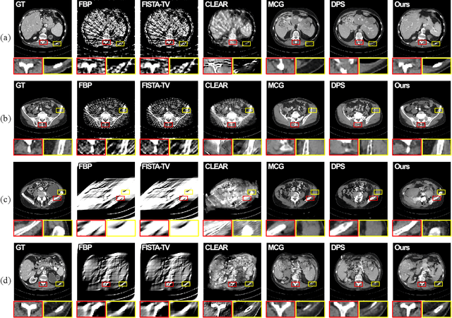 Figure 3 for Iterative Reconstruction Based on Latent Diffusion Model for Sparse Data Reconstruction