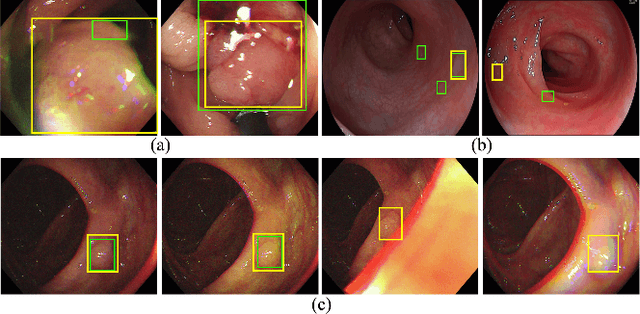 Figure 2 for ECC-PolypDet: Enhanced CenterNet with Contrastive Learning for Automatic Polyp Detection