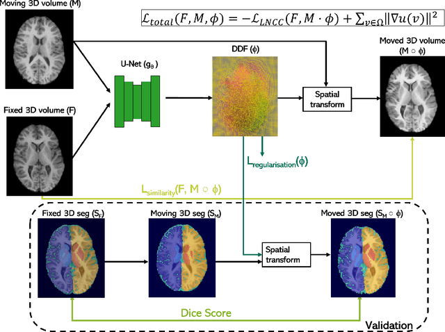 Figure 3 for Impact of Initialization on Intra-subject Pediatric Brain MR Image Registration: A Comparative Analysis between SyN ANTs and Deep Learning-Based Approaches