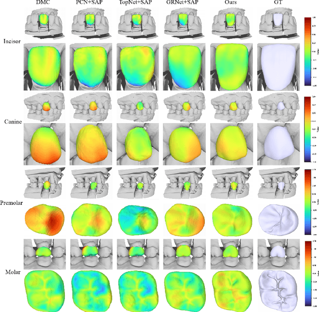 Figure 4 for VBCD: A Voxel-Based Framework for Personalized Dental Crown Design