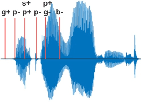 Figure 1 for Auto-Landmark: Acoustic Landmark Dataset and Open-Source Toolkit for Landmark Extraction