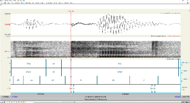 Figure 3 for Auto-Landmark: Acoustic Landmark Dataset and Open-Source Toolkit for Landmark Extraction