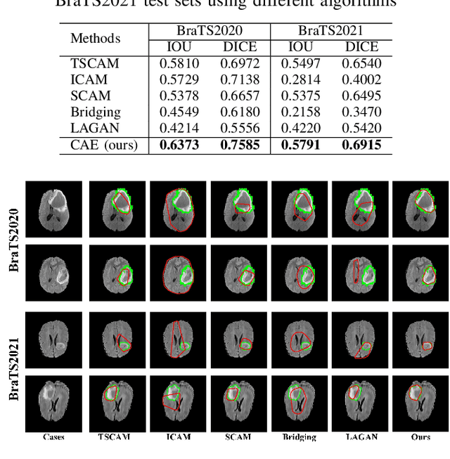 Figure 4 for A Weakly Supervised and Globally Explainable Learning Framework for Brain Tumor Segmentation