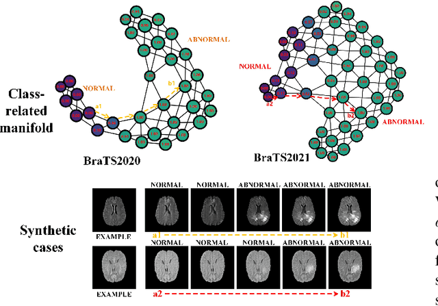 Figure 3 for A Weakly Supervised and Globally Explainable Learning Framework for Brain Tumor Segmentation