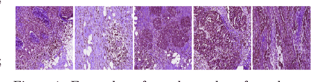 Figure 1 for Enhancing Transformer-Based Segmentation for Breast Cancer Diagnosis using Auto-Augmentation and Search Optimisation Techniques