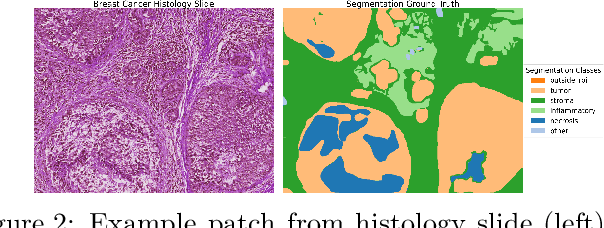 Figure 3 for Enhancing Transformer-Based Segmentation for Breast Cancer Diagnosis using Auto-Augmentation and Search Optimisation Techniques