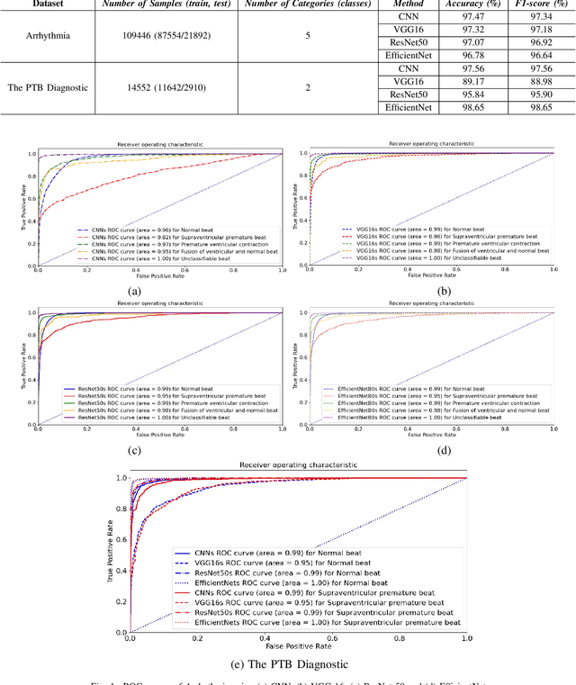 Figure 4 for ECG classification using Deep CNN and Gramian Angular Field