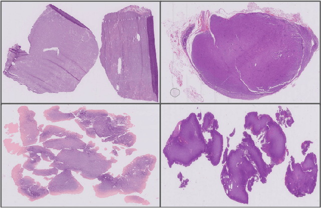 Figure 1 for Classification and Morphological Analysis of DLBCL Subtypes in H\&E-Stained Slides