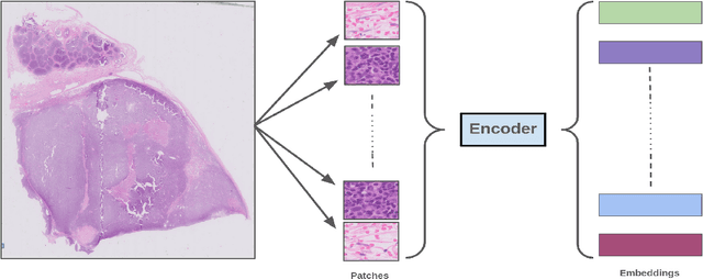 Figure 3 for Classification and Morphological Analysis of DLBCL Subtypes in H\&E-Stained Slides