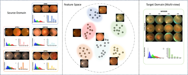 Figure 1 for RetiGen: A Framework for Generalized Retinal Diagnosis Using Multi-View Fundus Images