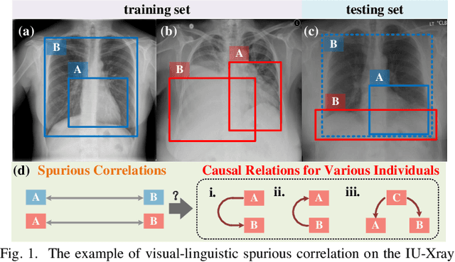 Figure 1 for Visual-Linguistic Causal Intervention for Radiology Report Generation