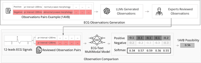 Figure 1 for Interpretable Multimodal Zero-Shot ECG Diagnosis via Structured Clinical Knowledge Alignment