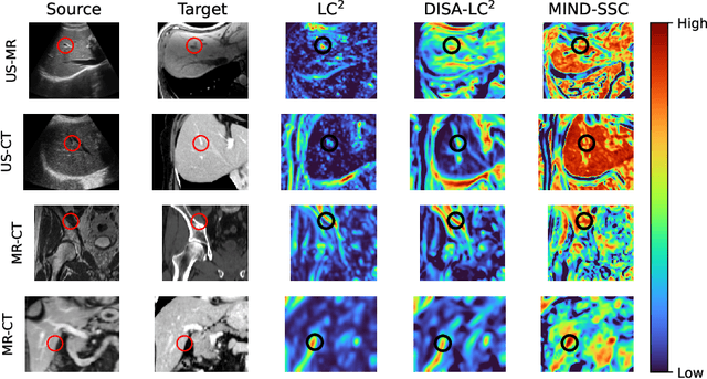 Figure 1 for DISA: DIfferentiable Similarity Approximation for Universal Multimodal Registration