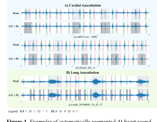 Figure 1 for Training one model to detect heart and lung sound events from single point auscultations