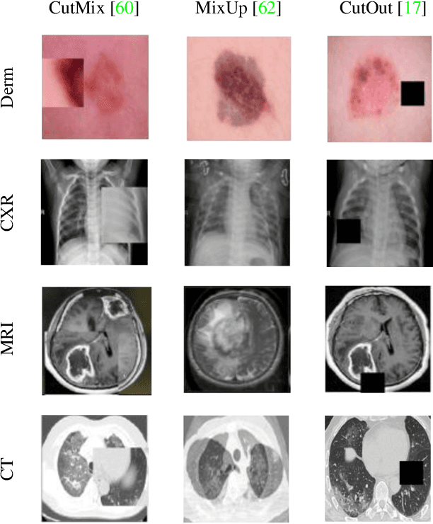 Figure 1 for Studying the Impact of Augmentations on Medical Confidence Calibration