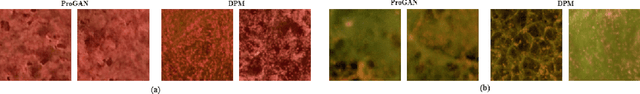 Figure 3 for Deep learning for automated detection of breast cancer in deep ultraviolet fluorescence images with diffusion probabilistic model