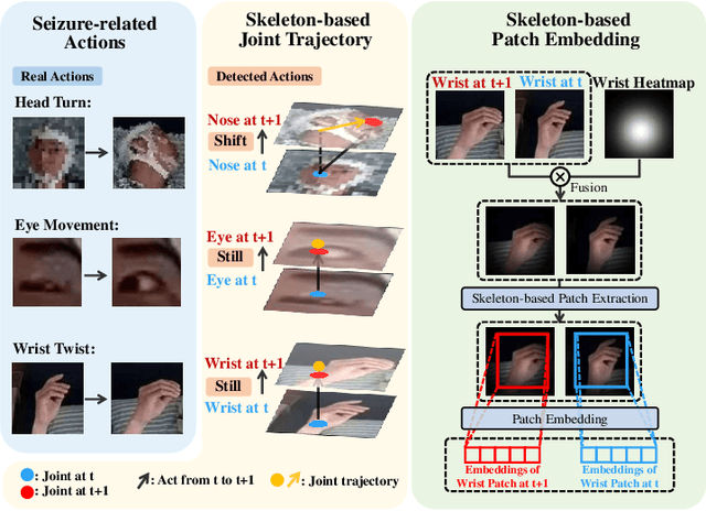 Figure 1 for READS-V: Real-time Automated Detection of Epileptic Seizures from Surveillance Videos via Skeleton-based Spatiotemporal ViG