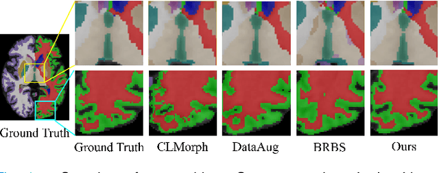 Figure 1 for Distillation Learning Guided by Image Reconstruction for One-Shot Medical Image Segmentation