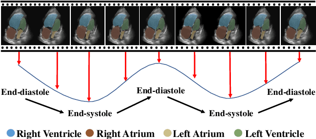 Figure 1 for GraphEcho: Graph-Driven Unsupervised Domain Adaptation for Echocardiogram Video Segmentation