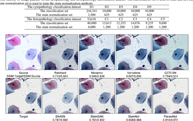 Figure 3 for ParamNet: A Parameter-variable Network for Fast Stain Normalization