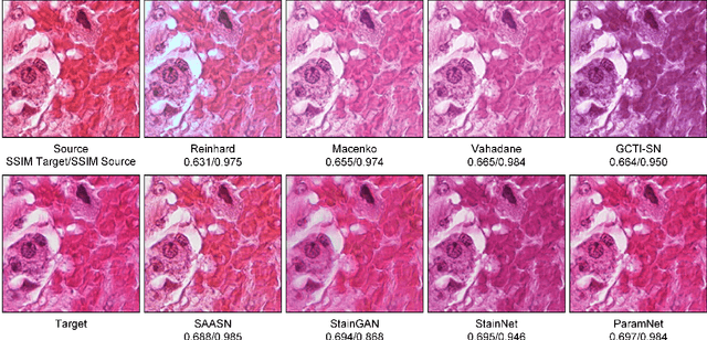 Figure 4 for ParamNet: A Parameter-variable Network for Fast Stain Normalization