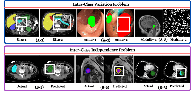 Figure 1 for Harmonized Spatial and Spectral Learning for Robust and Generalized Medical Image Segmentation