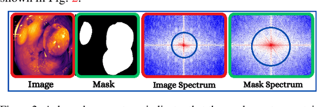 Figure 3 for Harmonized Spatial and Spectral Learning for Robust and Generalized Medical Image Segmentation