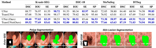 Figure 2 for Harmonized Spatial and Spectral Learning for Robust and Generalized Medical Image Segmentation