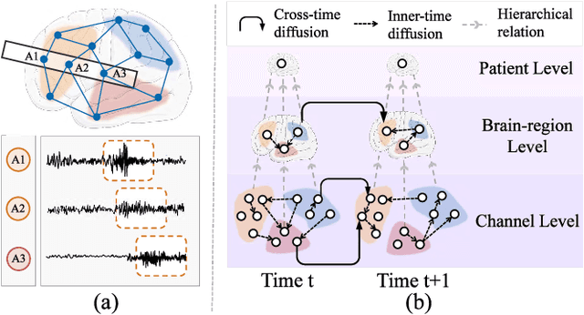 Figure 1 for BrainNet: Epileptic Wave Detection from SEEG with Hierarchical Graph Diffusion Learning