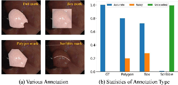 Figure 1 for ScribblePolyp: Scribble-Supervised Polyp Segmentation through Dual Consistency Alignment